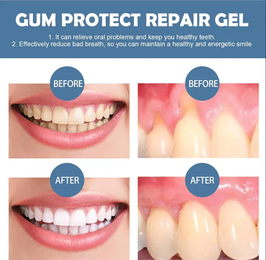 Gum Protect Zahnreparaturgel