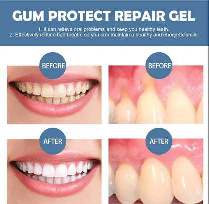 Gum Protect Zahnreparaturgel